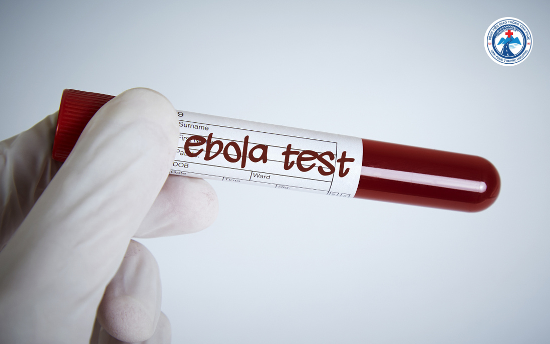 CẢNH GIÁC VỚI BỆNH EBOLA – CHỦ ĐỘNG PHÒNG NGỪA ĐỂ BẢO VỆ SỨC KHỎE CỘNG ĐỒNG