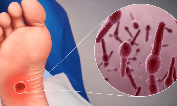 Bệnh Uốn Ván Là Gi Bắt Nguồn Từ Đâu?